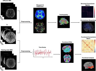 Alternations and Applications of the Structural and Functional Connectome in Gliomas: A Mini-Review